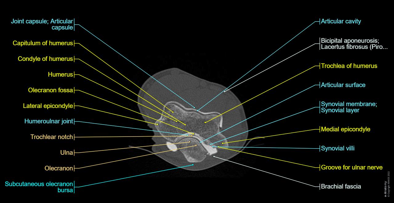 Anatomy of the elbow - CT Arthrogram