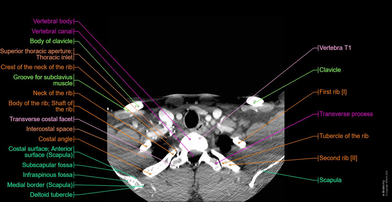 CT scan of head and neck: normal anatomy | e-Anatomy