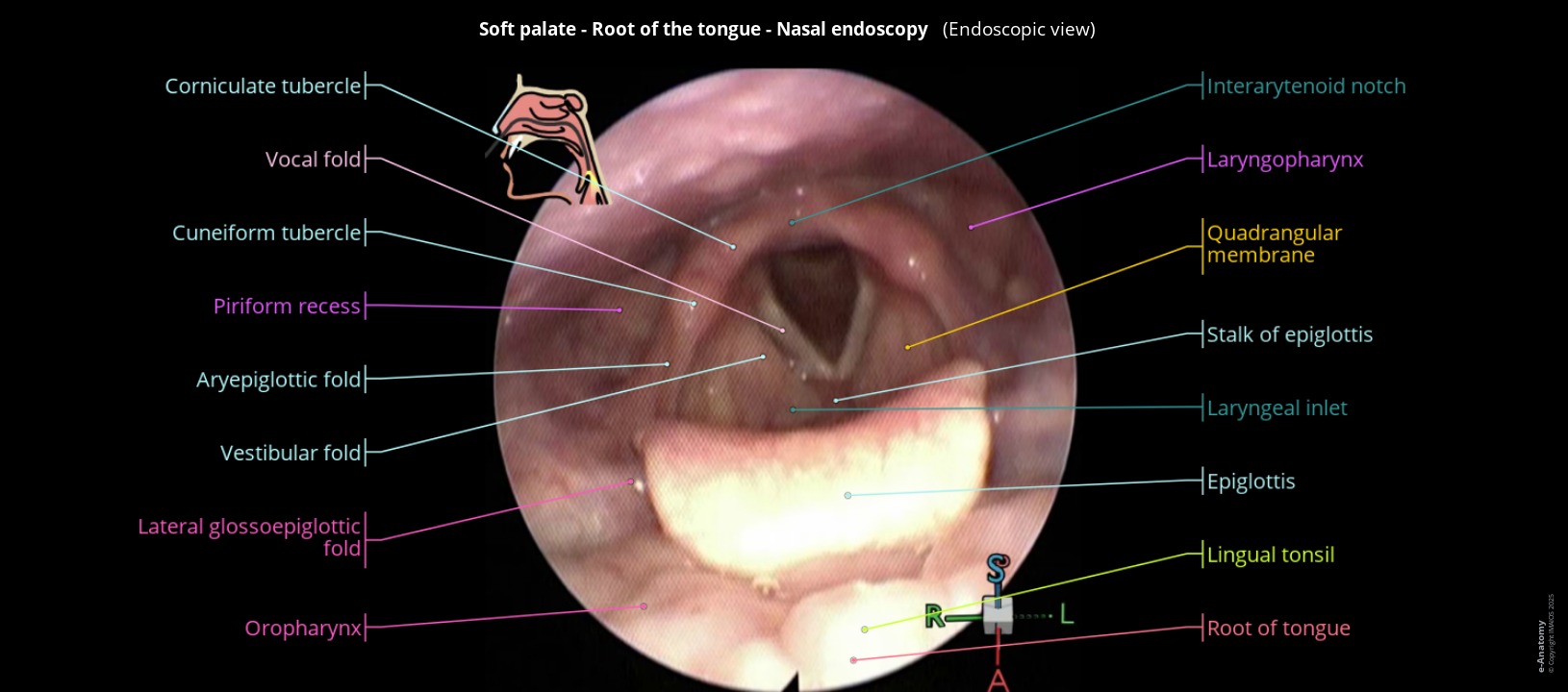 Labelled nasal endoscopy in human: the laryngeal inlet