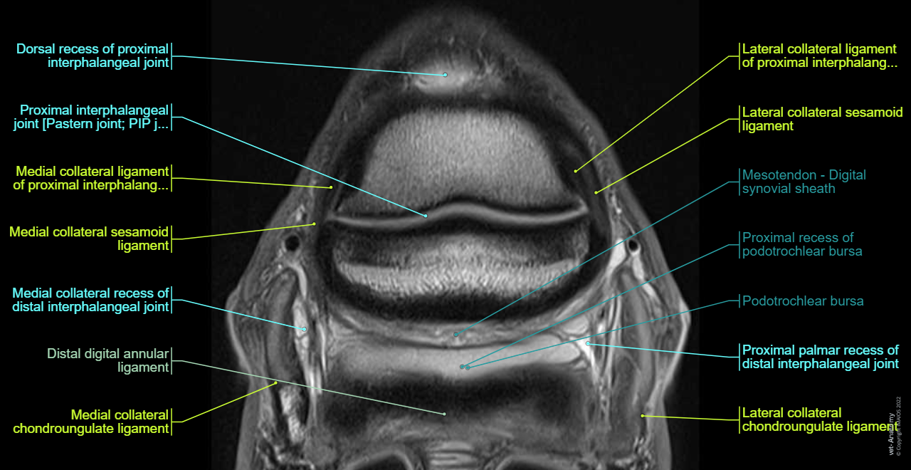Horse - Cross-sectional anatomy (MRI - CLL PD): Lateral collateral sesamoid ligament, Medial collateral sesamoid ligament, Lateral collateral ligament - Distal interphalangeal joint [Coffin joint; DIP joint], Distal digital annular ligament