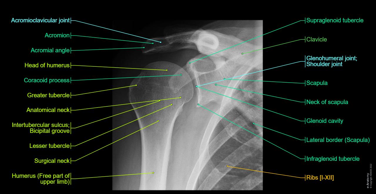Shoulder - Pectoral girdle; Shoulder girdle - Radiographs - Human anatomy : Glenohumeral joint; Shoulder joint, Acromion, Clavicle, Scapula, Glenoid cavity, Lesser tubercle, Coracoid process