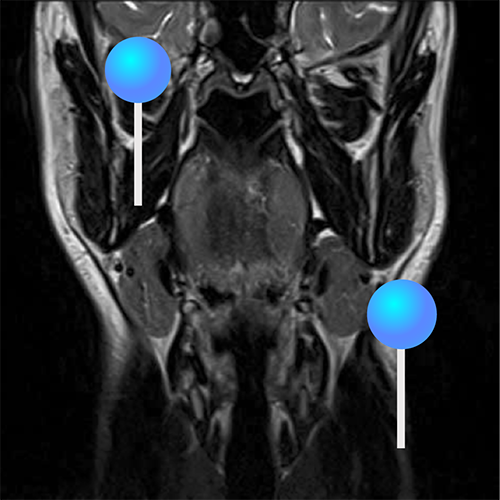 脸与颈部 MRI : 正常解剖 | e-Anatomy
