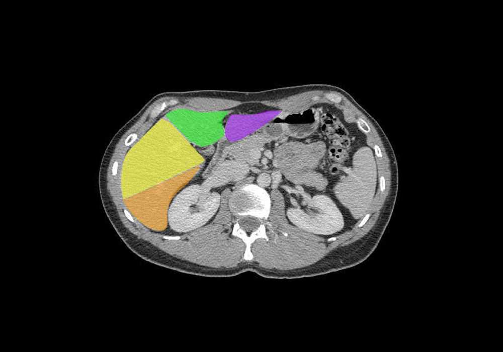 Anatomy of the abdomen and male pelvis using cross-sectional imaging - interactive atlas of human anatomy