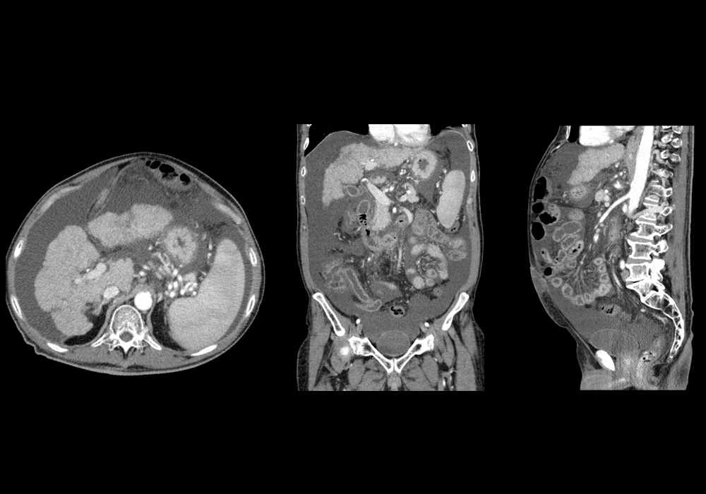 Anatomy of the abdominopelvic cavity