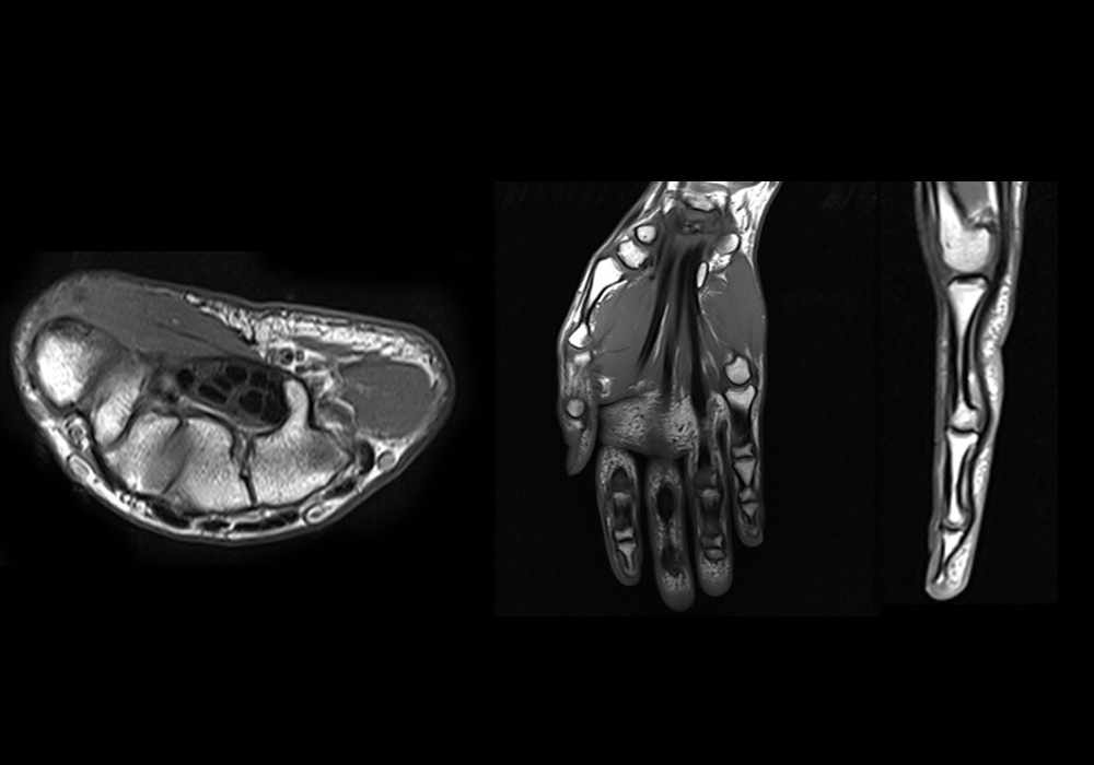 The hand: normal anatomy | e-Anatomy