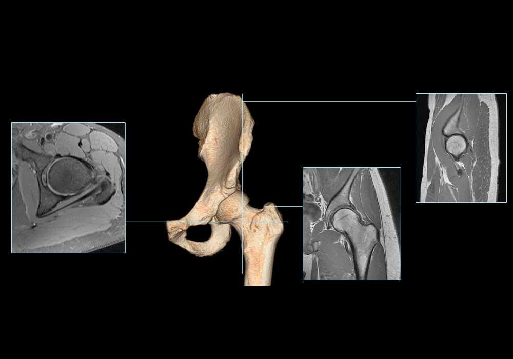 Anatomy of the hip (cross-sectional imaging on 3T MR and 3D medical pictures)
