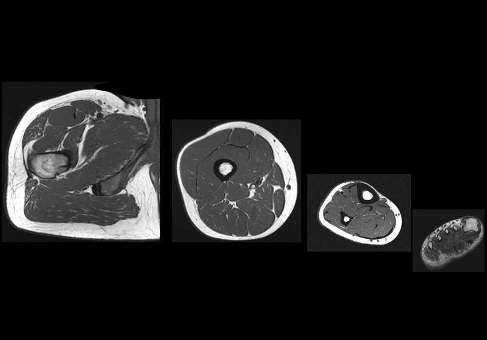 MRI of the lower limb anatomy - atlas of the human body using cross-sectional imaging