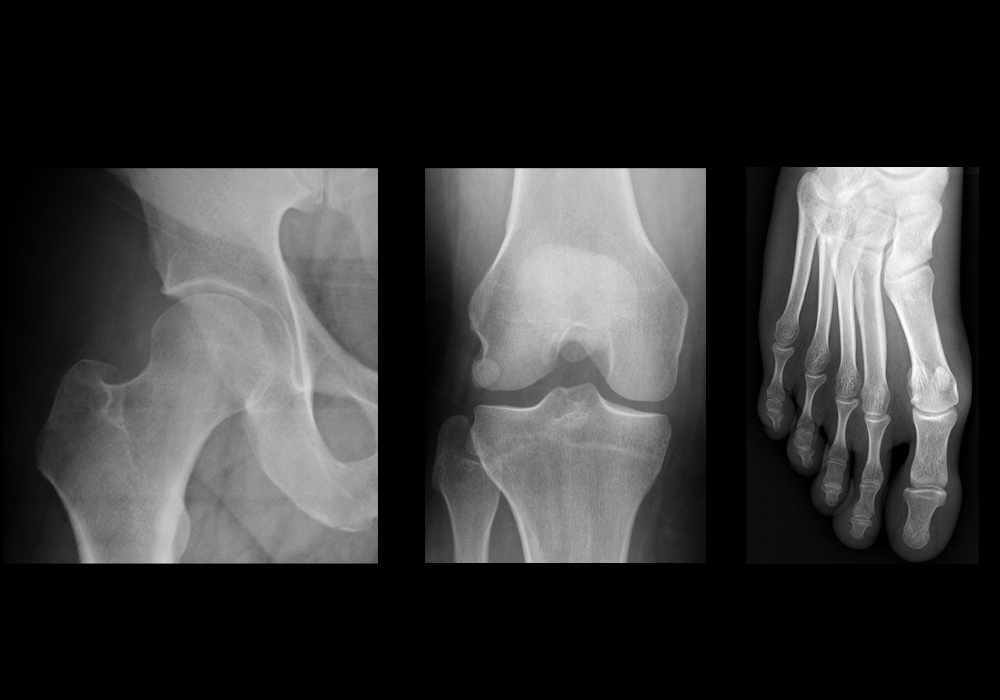 Anatomy of the lower limb in standard radiology