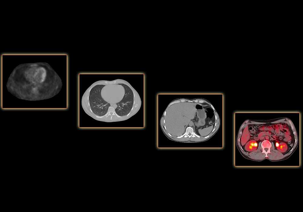 PET-CT atlas of the whole body