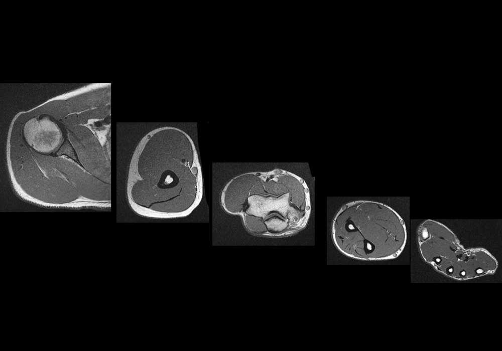 MRI of the upper limb anatomy - Atlas of the human body using cross-sectional imaging