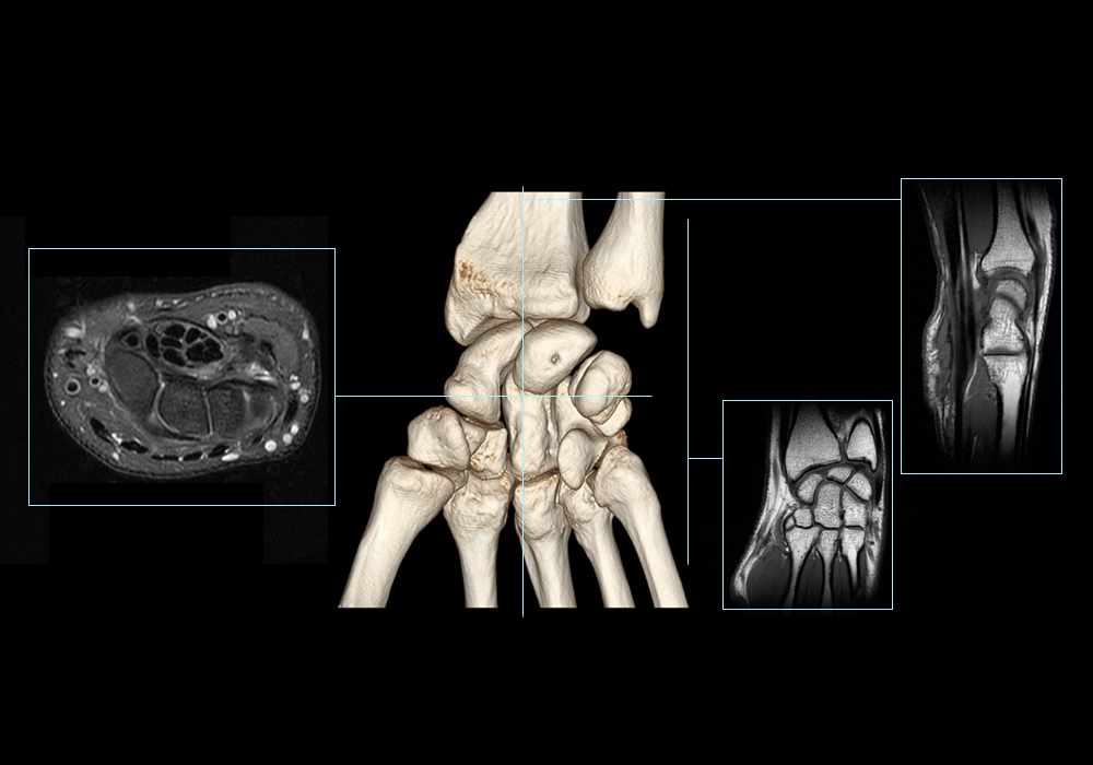 Anatomy of the wrist (cross-sectional imaging on 3T MR and 3D medical pictures)