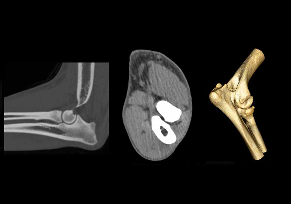 Anatomy of left elbow of the dog on CT imaging (elbow joint, brachial muscles, humerus, radius and ulna)