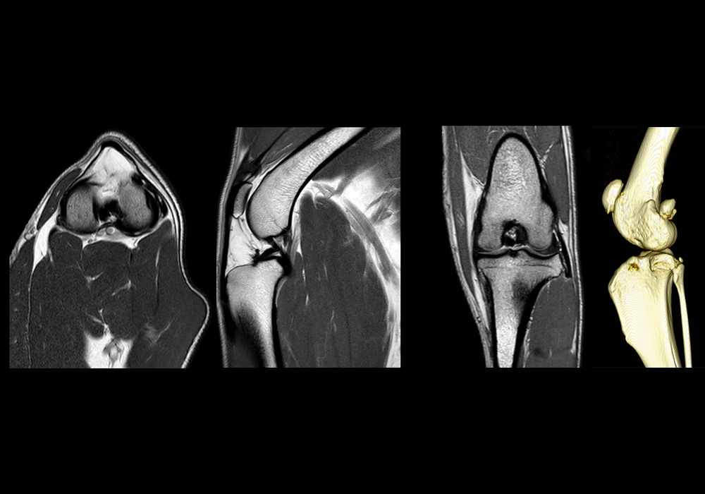 Anatomy of the canine stifle joint on magnetic resonance imaging (MRI)
